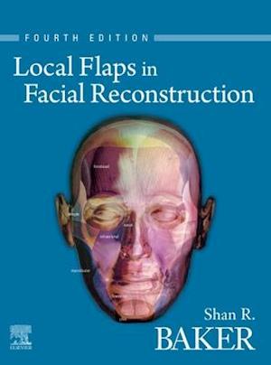 Local Flaps in Facial Reconstruction E-Book