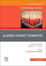 Allergic Contact Dermatitis,An Issue of Dermatologic Clinics