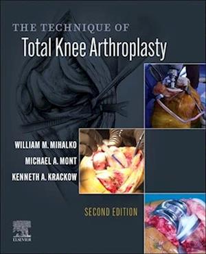 Technique of Total Knee Arthroplasty E-Book