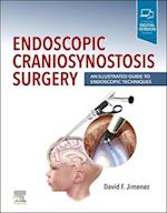 Endoscopic Craniosynostosis Surgery