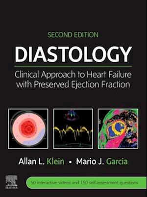 Diastology E-Book