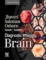 Diagnostic Imaging: Brain E-Book