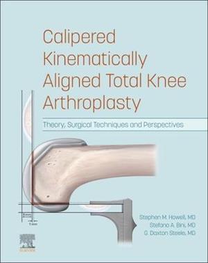 Calipered Kinematically aligned Total Knee Arthroplasty E-Book