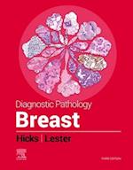 Diagnostic Pathology: Breast, E-Book