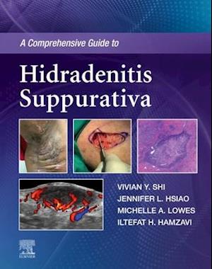 Comprehensive Guide to Hidradenitis Suppurativa - EBook