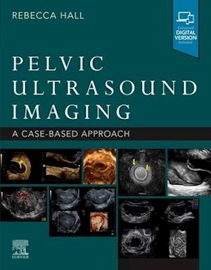 Pelvic Ultrasound Imaging