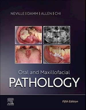 Oral and Maxillofacial Pathology - E-Book