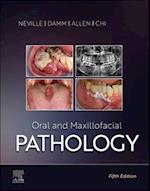 Oral and Maxillofacial Pathology - E-Book