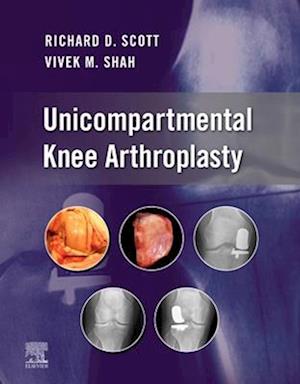 Unicompartmental Knee Arthroplasty, E-Book