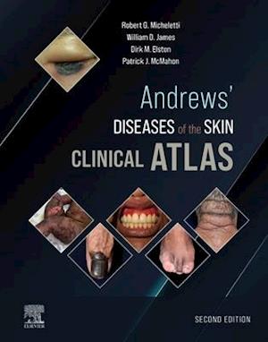 Andrews' Diseases of the Skin Clinical Atlas,E-Book