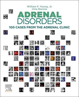 Adrenal Disorders