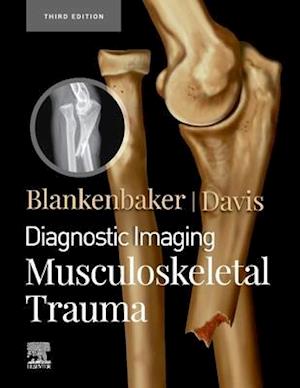 Diagnostic Imaging: Musculoskeletal Trauma,E-Book