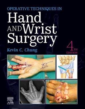 Operative Techniques: Hand and Wrist Surgery E-Book