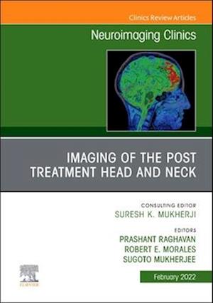 Imaging of the Post Treatment Head and Neck, An Issue of Neuroimaging Clinics of North America