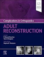 Complications in Orthopaedics: Adult Reconstruction