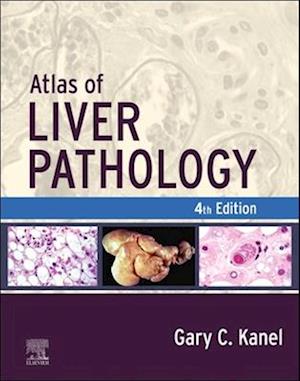 Atlas of Liver Pathology - E-Book