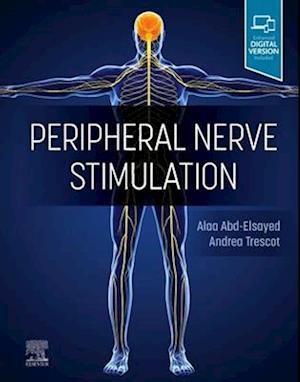 Peripheral Nerve Stimulation