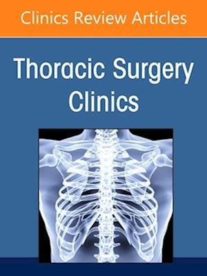 Esophageal Cancer,An Issue of Thoracic Surgery Clinics, E-Book