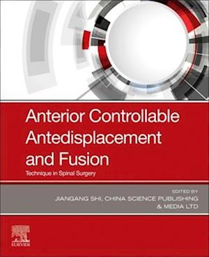 Anterior Controllable Antedisplacement and Fusion (ACAF)