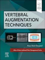 Vertebral Augmentation Techniques - E-Book