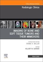 Imaging of Bone and Soft Tissue Tumors and Their Mimickers, An Issue of Radiologic Clinics of North America