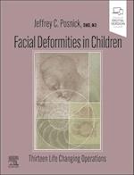 Facial Deformities in Children