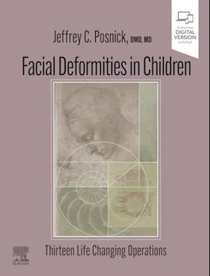 Facial Deformities in Children - E-Book