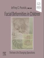 Facial Deformities in Children - E-Book