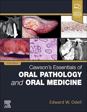 Cawson's Essentials of Oral Pathology and Oral Medicine