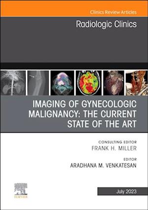 Imaging of Gynecologic Malignancy: The Current State of the Art, An Issue of Radiologic Clinics of North America, E-Book