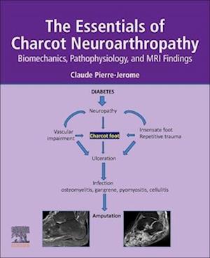 The Essentials of Charcot Neuroarthropathy