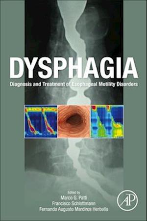 Dysphagia