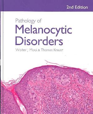 Pathology of Melanocytic Disorders 2ed