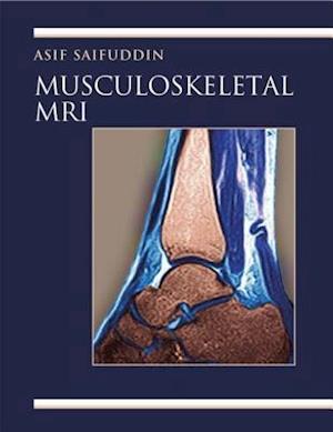 Musculoskeletal MRI