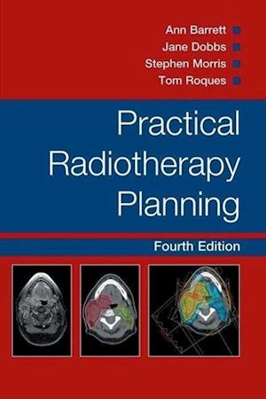 Practical Radiotherapy Planning