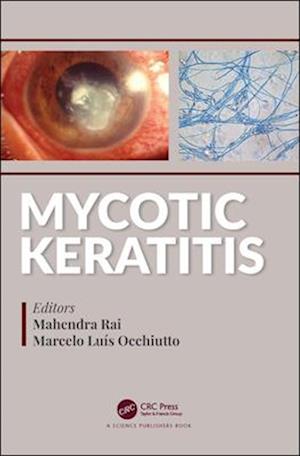 Mycotic Keratitis