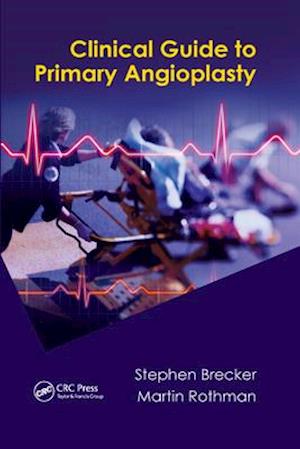 Clinical Guide to Primary Angioplasty