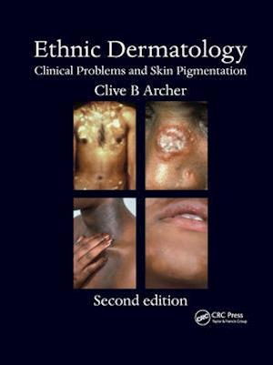 Ethnic Dermatology