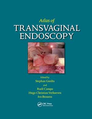 Atlas of Transvaginal Endoscopy