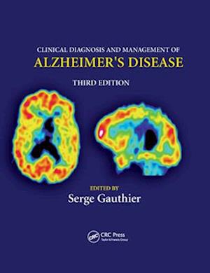 Clinical Diagnosis and Management of Alzheimer's Disease