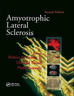 Amyotrophic Lateral Sclerosis, Second Edition