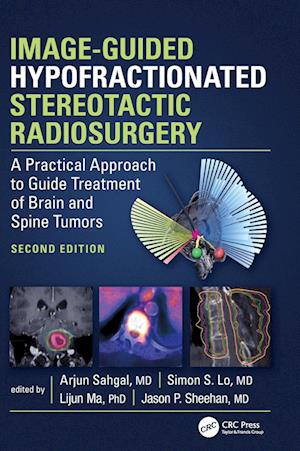 Image-Guided Hypofractionated Stereotactic Radiosurgery