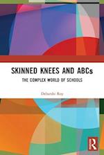 Skinned Knees and ABCs