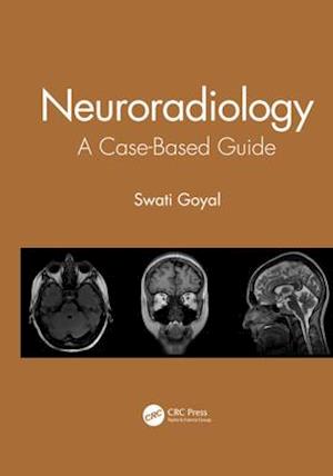 Neuroradiology