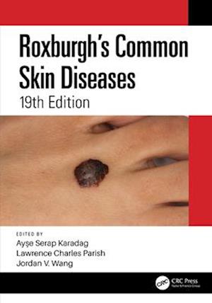 Roxburgh's Common Skin Diseases