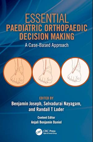 Essential Paediatric Orthopaedic Decision Making