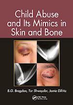 Child Abuse and Its Mimics in Skin and Bone