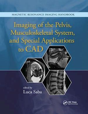 Imaging of the Pelvis, Musculoskeletal System, and Special Applications to CAD