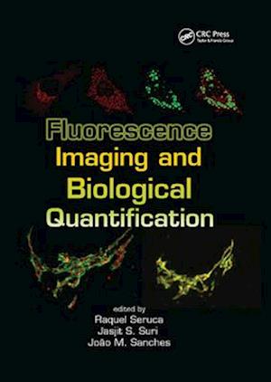 Fluorescence Imaging and Biological Quantification