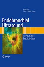 Endobronchial Ultrasound